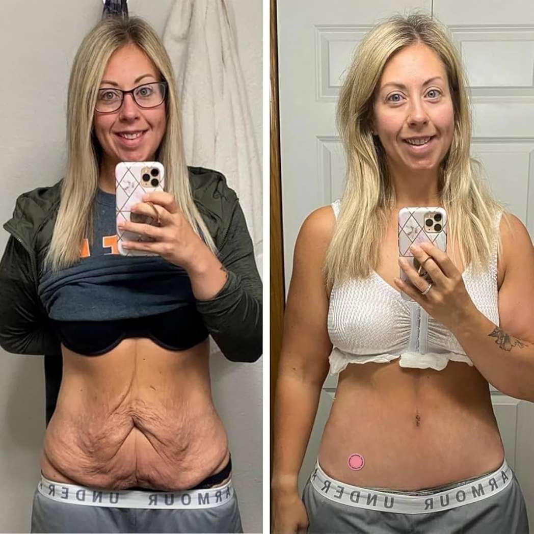 Lenobio GLP-1 Parches (30 + 30 GRATIS)