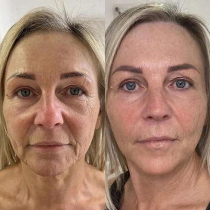 Efecto Koreano Piel de Cristal | Mascarilla Bio-Colágeno