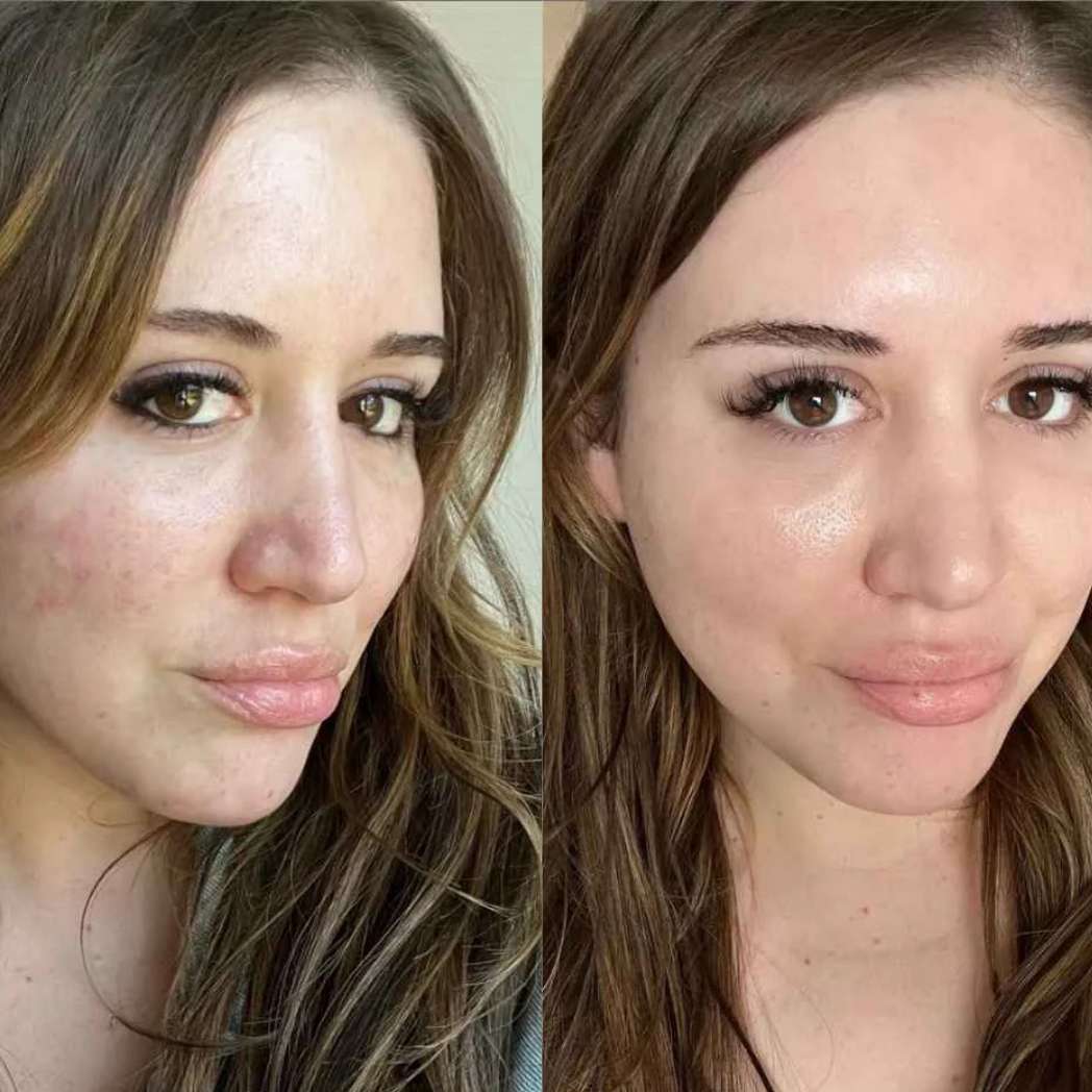 Efecto Koreano Piel de Cristal | Mascarilla Bio-Colágeno